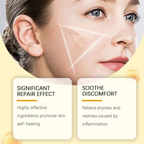 Houkea Bee Venom Gently Cleanses Removes Nevus Moisturizing And Soothing Skin Care Cream