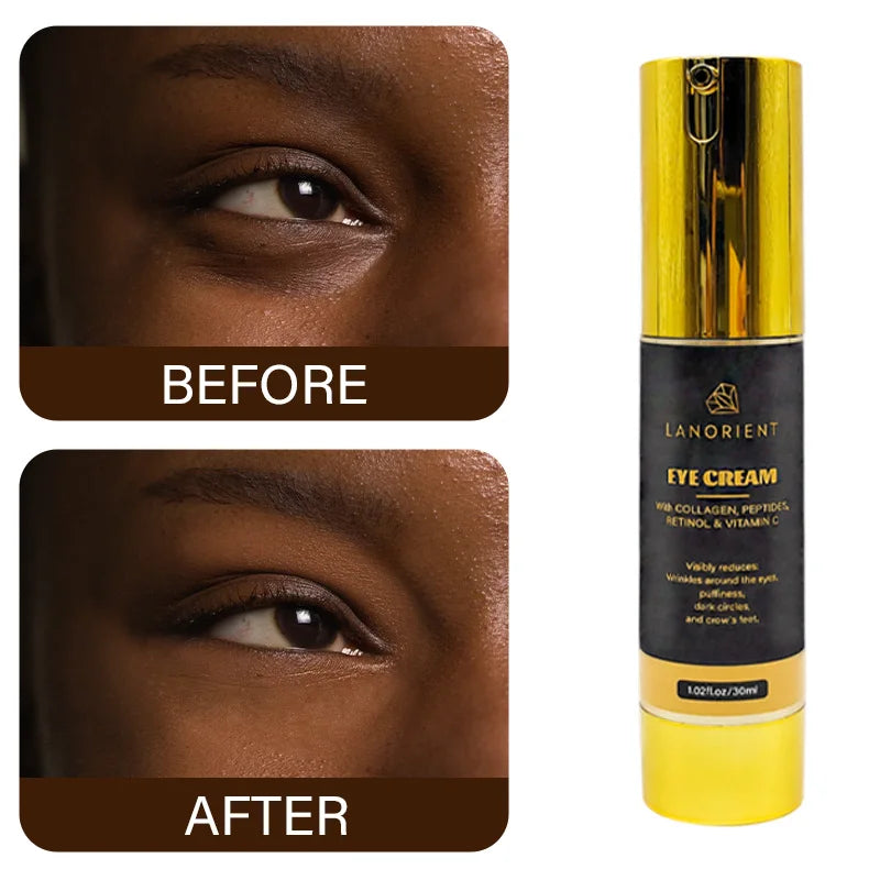 OEM Customized Korean Skin Care Cosmetics to Remove Dark Circles Brightening Niacinamide Eye Cream Retinol Eye Tightening Cream